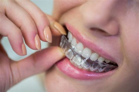 How Often Should You Replace Your Plastic Retainer and Why Do They Sometimes Smell Like Old Socks?